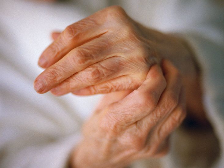 Arthritis vs. Arthralgia: What’s the Difference?
