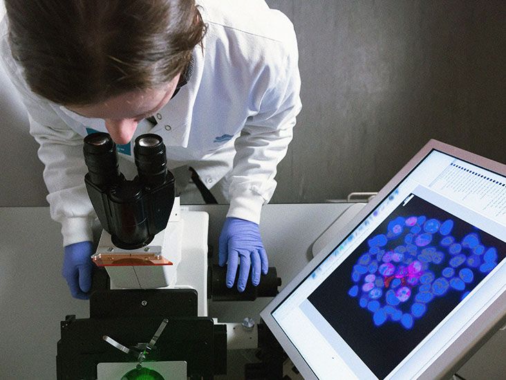 Survival Rate for Pancreatic Cancer: Stage, Age, and More