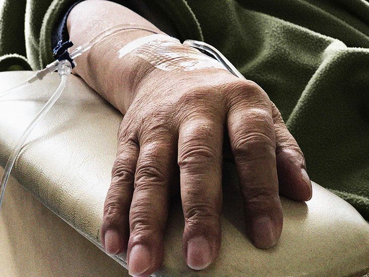 CML blast crisis phase: Definition, symptoms, and more