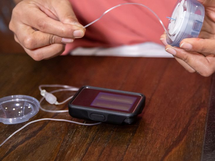 A Guide to Insulin Pumps and New Diabetes Technology