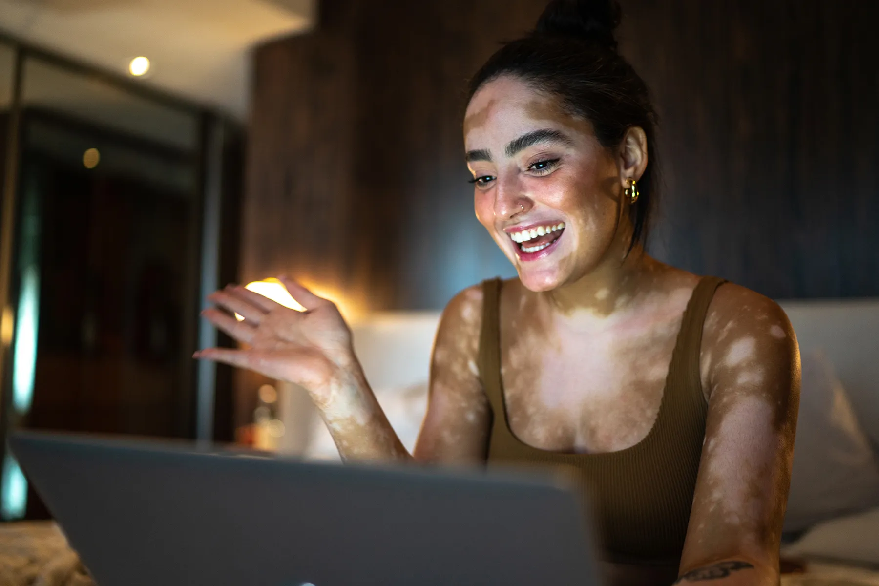 Living Optimistically with Vitiligo