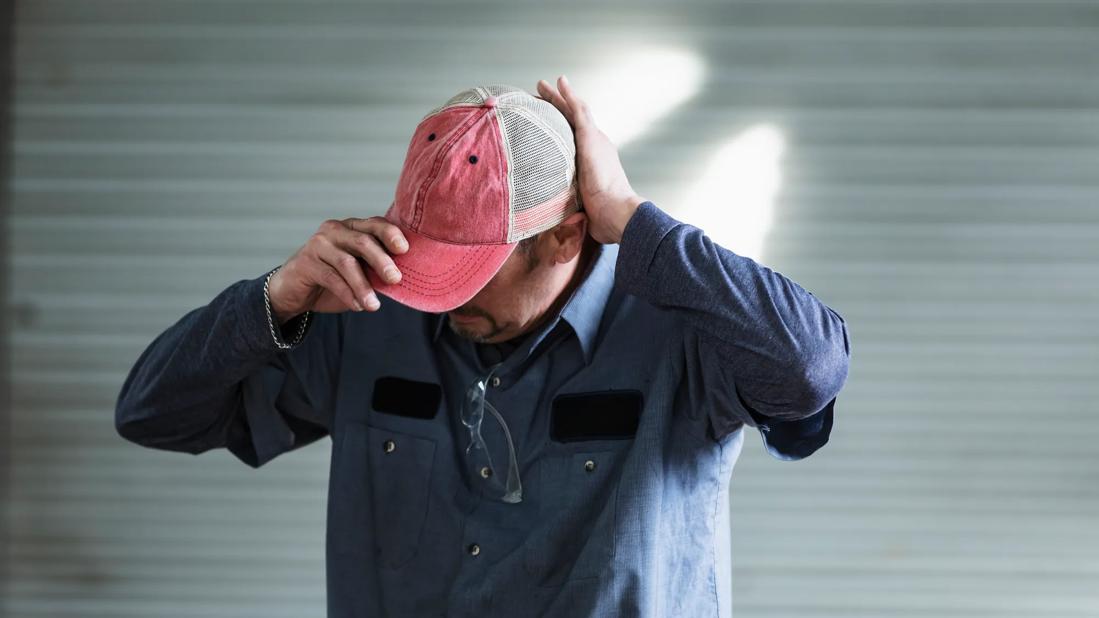 Does Wearing a Hat Cause Hair Loss?